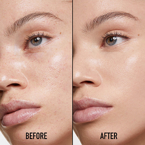 Dior Diorskin Forever Skin Correct Concealer (1.5N Neutral) 11ml