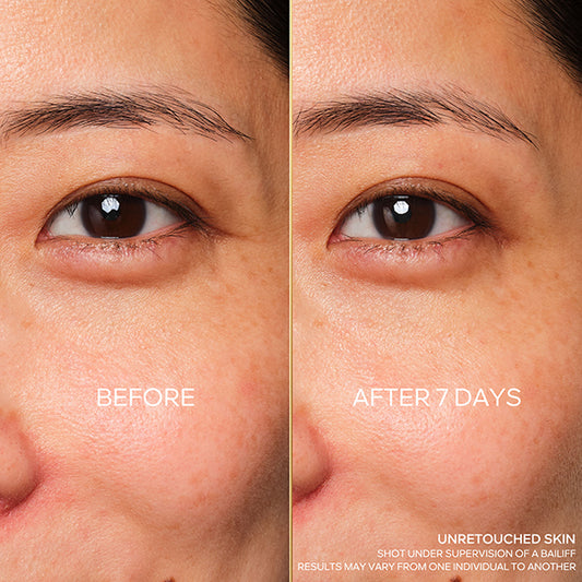 GUERLAIN Abeille Royale Youth Eye R Repair Serum, 15ml