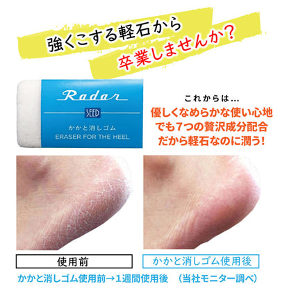 Radar Kakato Eraser (Heel Buffer)