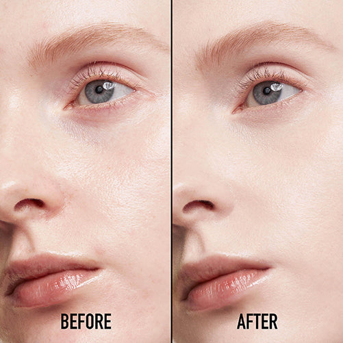 Dior Diorskin Forever Skin Correct Concealer, 00 Neutral, 11ml