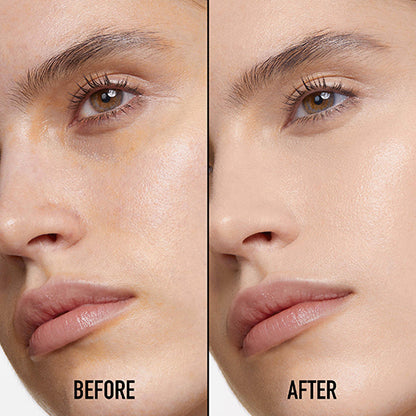 Dior Diorskin Forever Skin Correct Concealer, 2N Neutral, 11ml