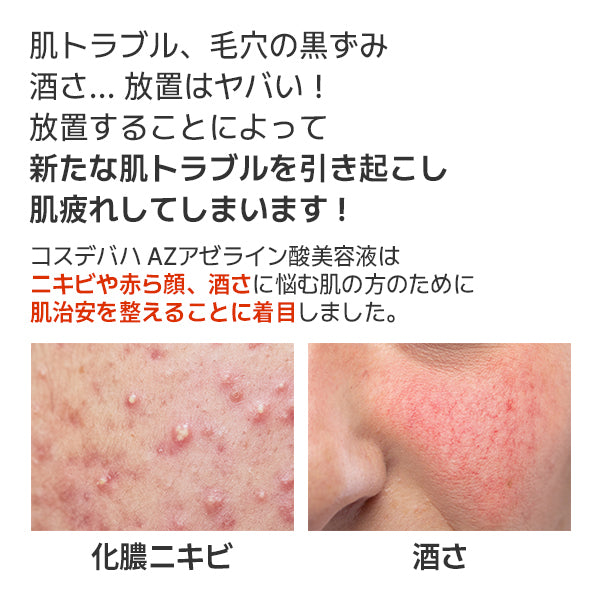 CosDeBAHA AZ Azelaic Acid 10 Serum, 30ml
