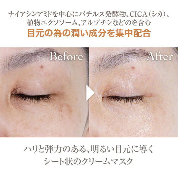 Eye Zone Cream Serum Mask, 10 bags