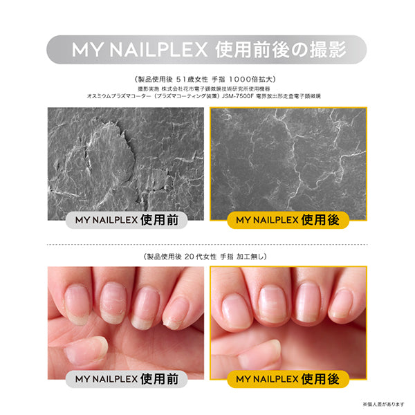 TITANAIL MY NAILPLEX (Bergamot & Lemon), 10ml