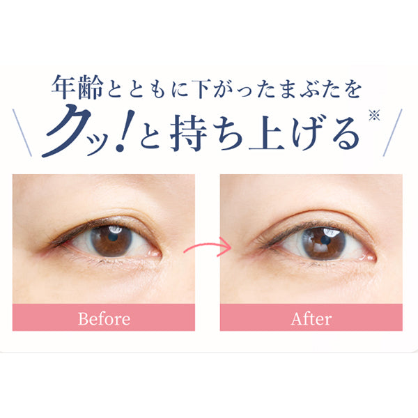 Mezaik Eye Kutto Adhesive Lifting Type, 3.5ml